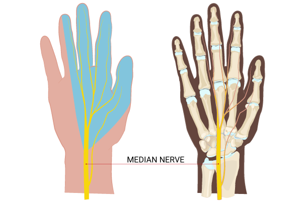 Carpal-tunnel-syndrome 2020-01-13T11_36_54.981Z.png