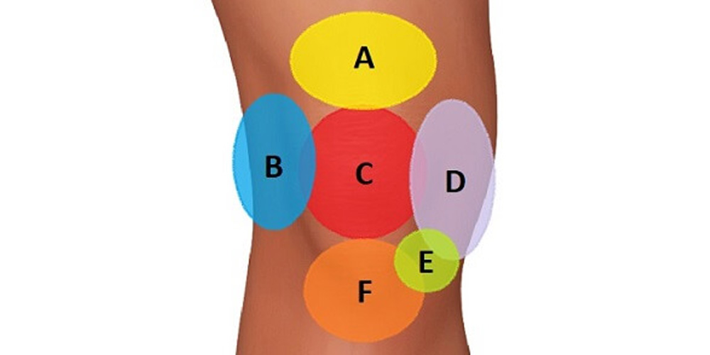 knee-pain-location-chart-treatments