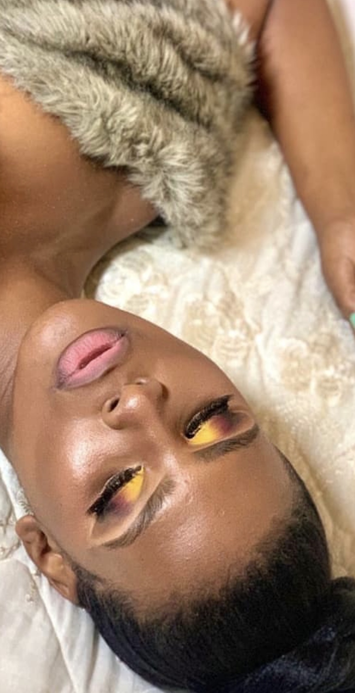 face beat by bee