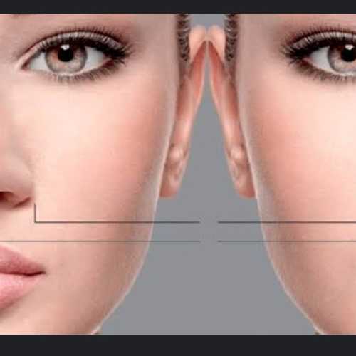 Lumom Beauty (Facial)
