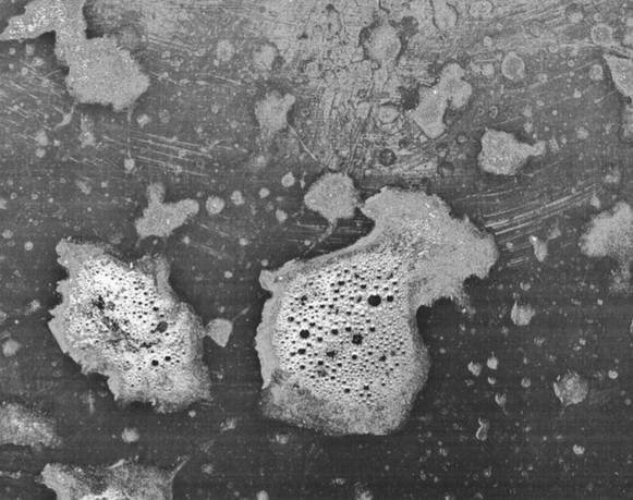 Blowhole: Beso de diez