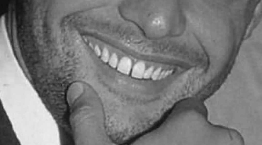 Gaptooth