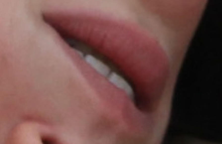THE ROOF: Beso Inverso