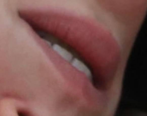 THE ROOF: Beso Inverso