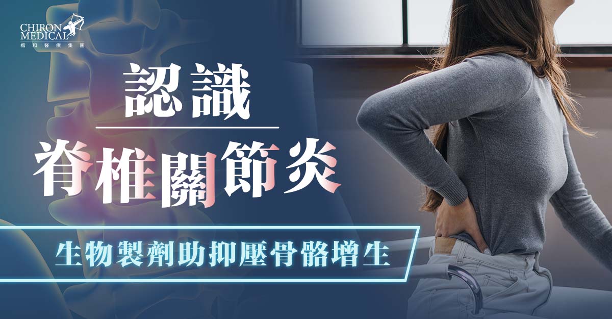 鍾浩然醫生 — 認識脊椎關節炎 生物製劑助抑壓骨骼增生