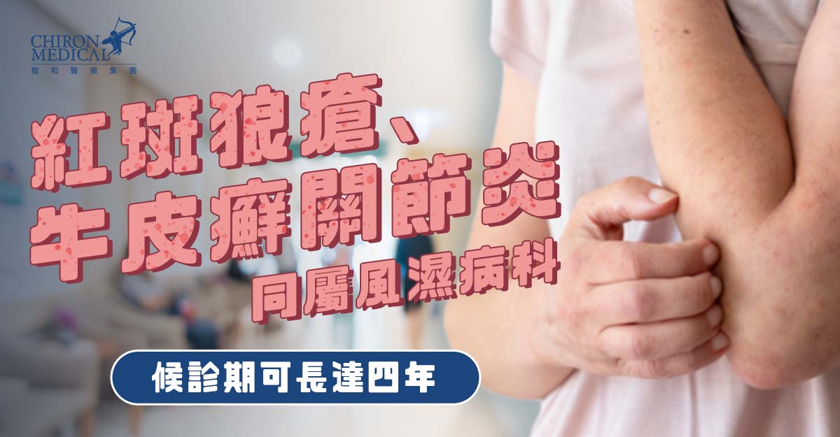 鍾浩然醫生 — 紅斑狼瘡、牛皮癬關節炎同屬風濕病科 候診期可長達四年