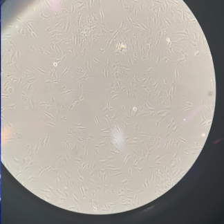 Thumbnail supplied by the source for The Degradation of Cartilage Cells in Microgravity