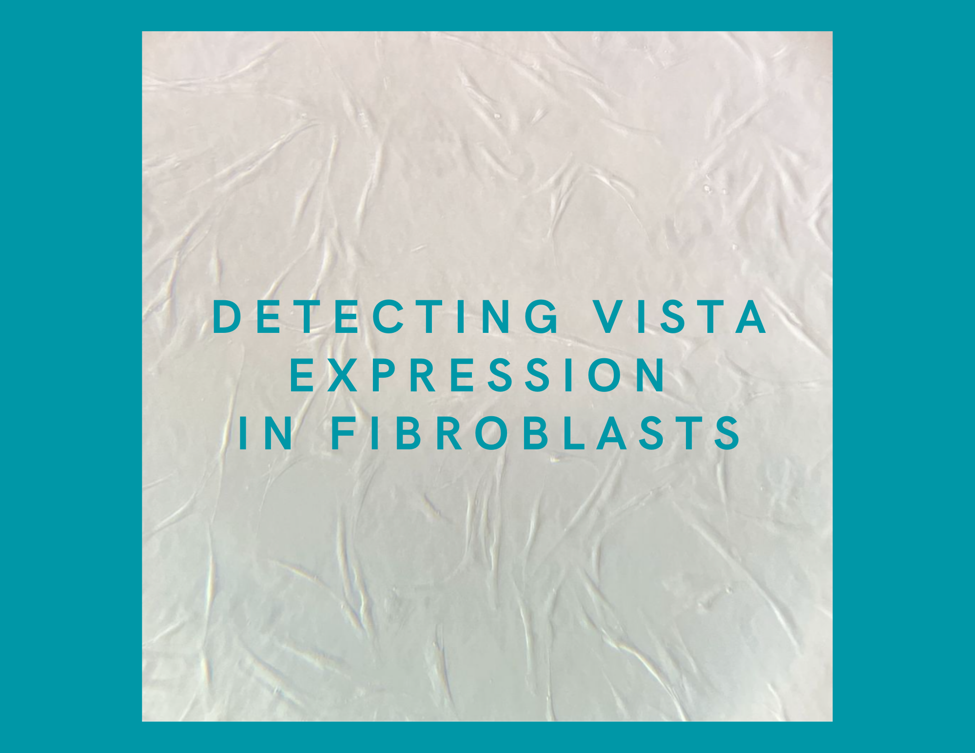 Thumbnail supplied by the source for VISTA downregulation in fibroblasts may upregulate IFN-1 expression, but more research is needed.