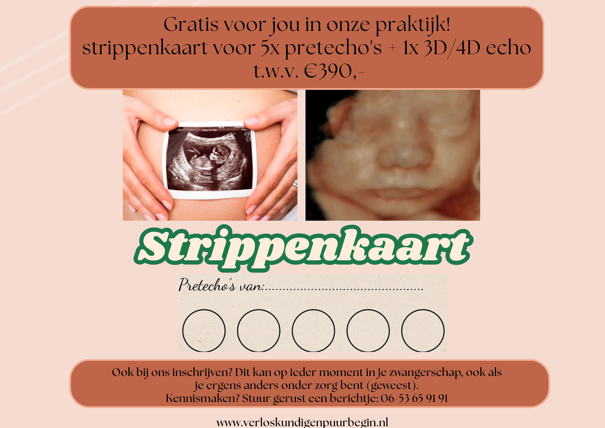 Echo strippenkaart Verloskundigen Dronten