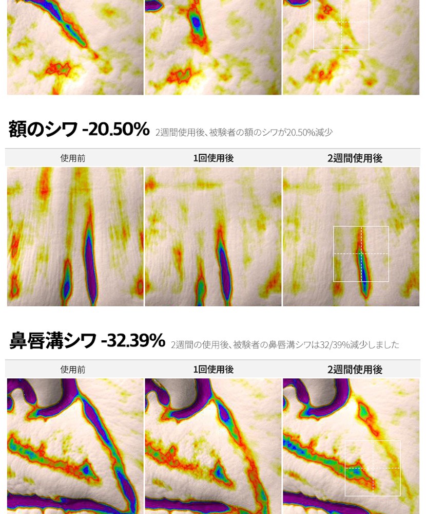 PDRN リフト クリーム 상세 이미지 13