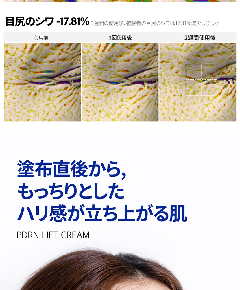 PDRN リフト クリーム 상세 이미지 14