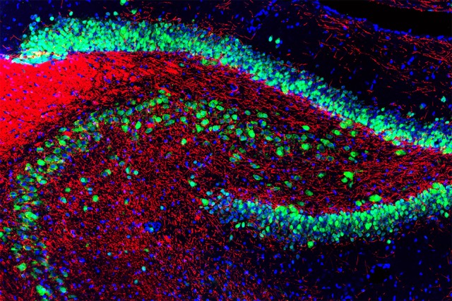 Optogenetics: Controlling Brain Cells with Light