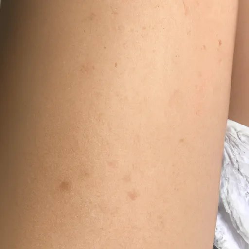 A picture of a person showing their skin