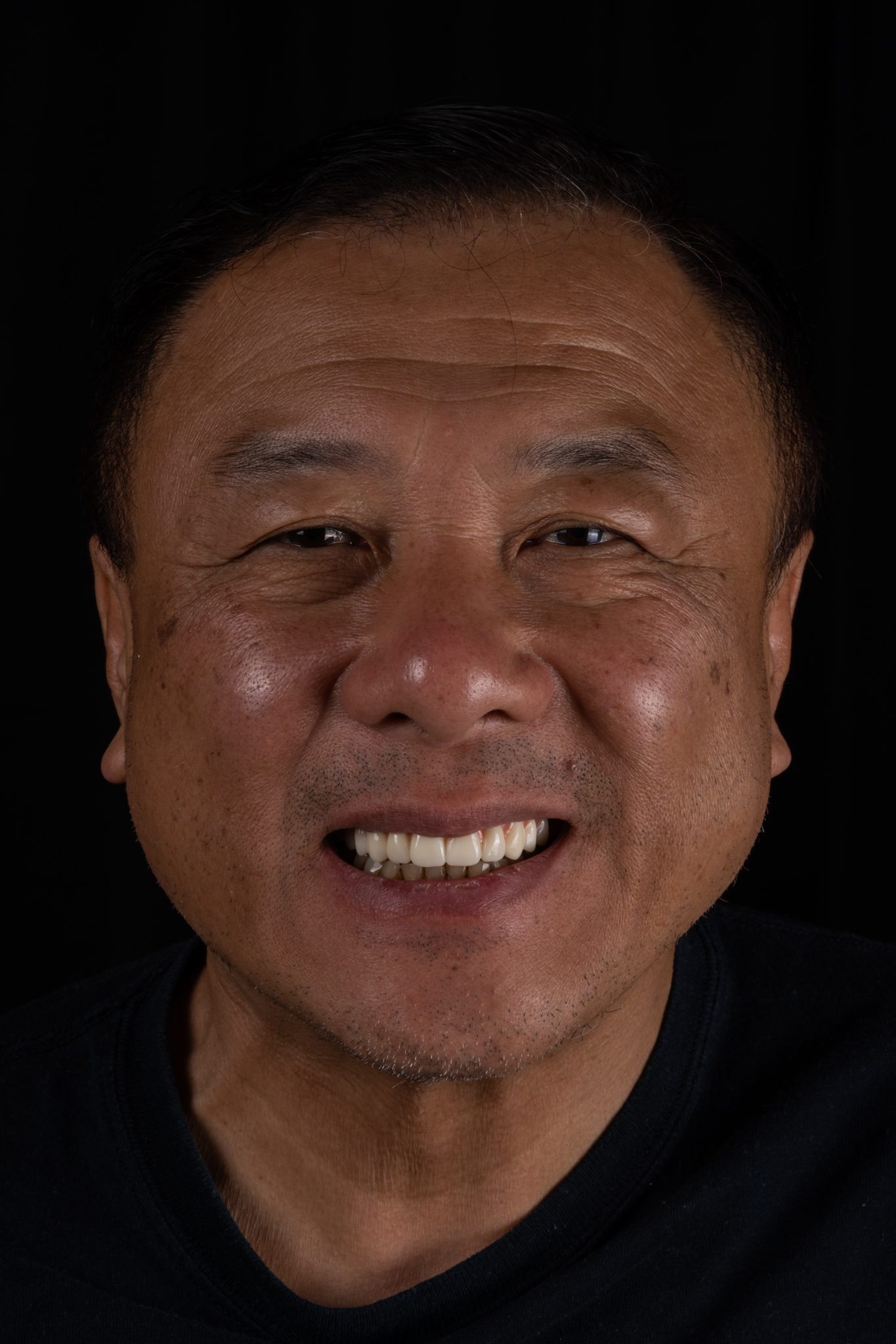 Patient smiling