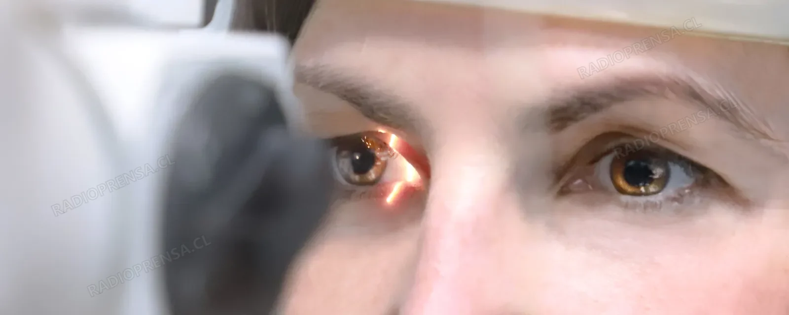 Salud Melipilla refuerza campaña de prevención de retinopatía en pacientes diabéticos con el examen Fondo de Ojo
