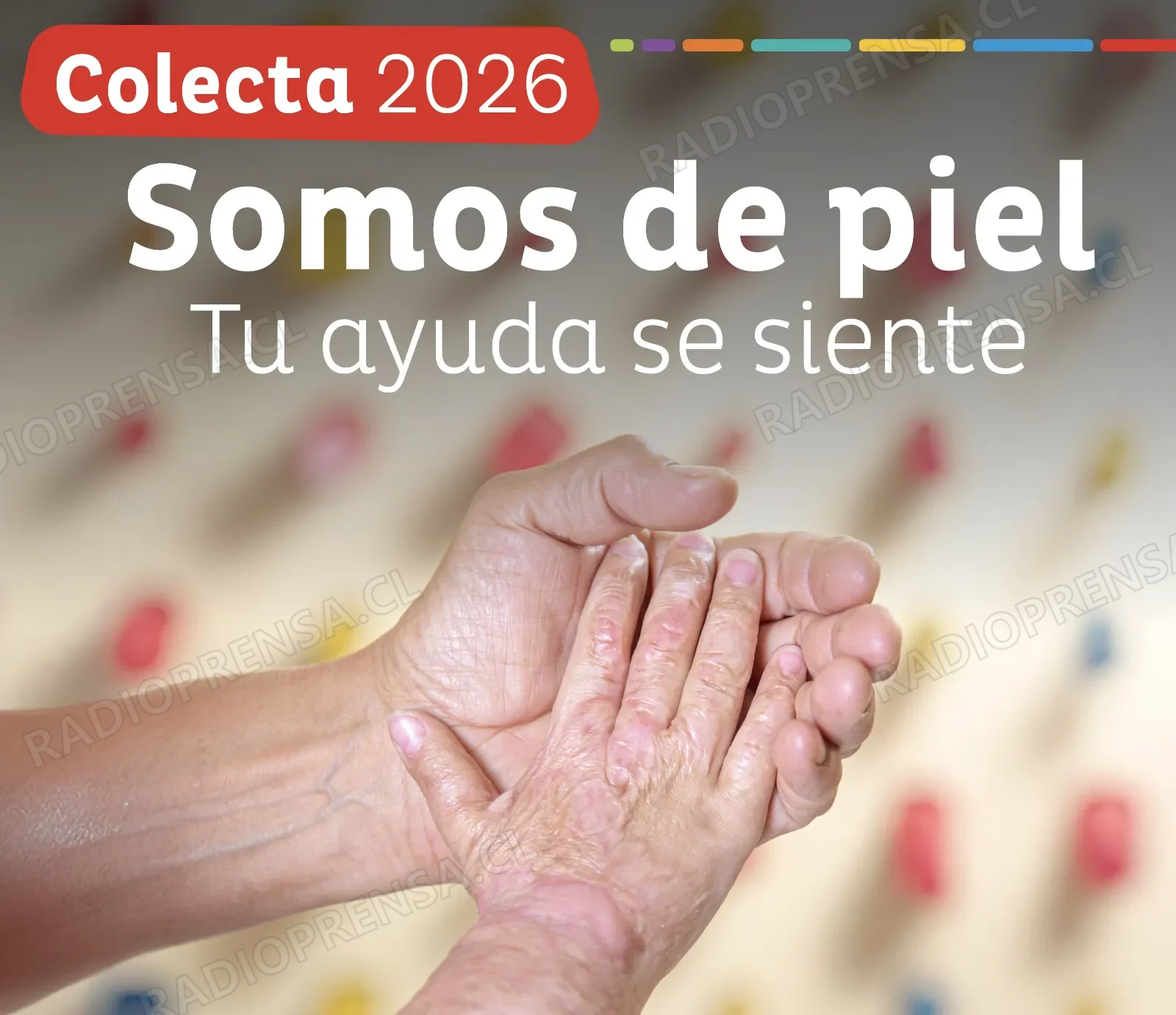 COANIQUEM inicia campaña de recaudación ante alarmante cifra de 80 mil niños quemados al año en Chile