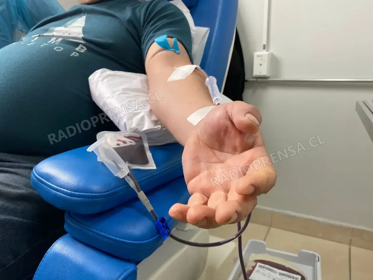 Realizarán jornada de donación de sangre para apoyar a joven de Talagante