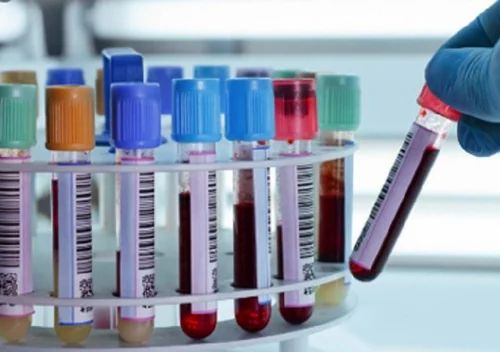 Blood Tests