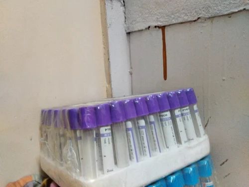 Blood Sample Test Tube