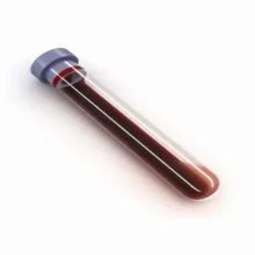 Blood Test Tube