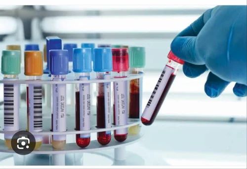 Blood Test Tube, 5 ml