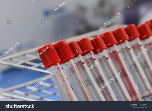 Non Vacuum Clot Activator Tubes