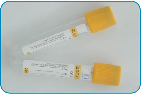 SST Tube (Serum Separate Tube)
