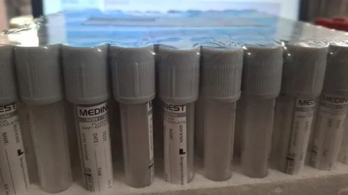 Sodium Fluoride Blood Collection Tube, 3 ml