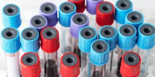 Plastic 1ml Blood Collection Tube