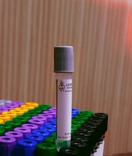 2ml Fluoride Non Vacuum Blood Collection Tube