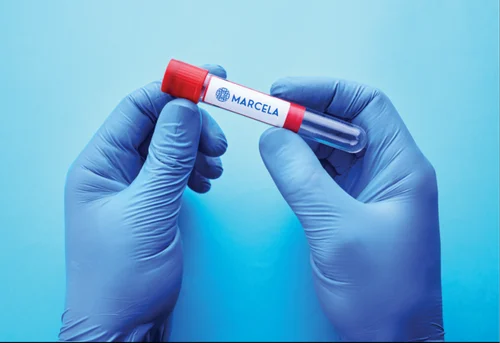 Plastic Plain Non Vacuum Blood Collection Tubes, For Laboratory, 2ML-10ML