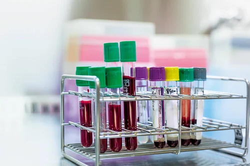 K3 Edta NON Vacuum Blood Collection Tube