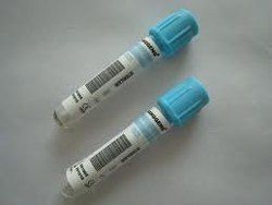 Blood Collection Test Tube