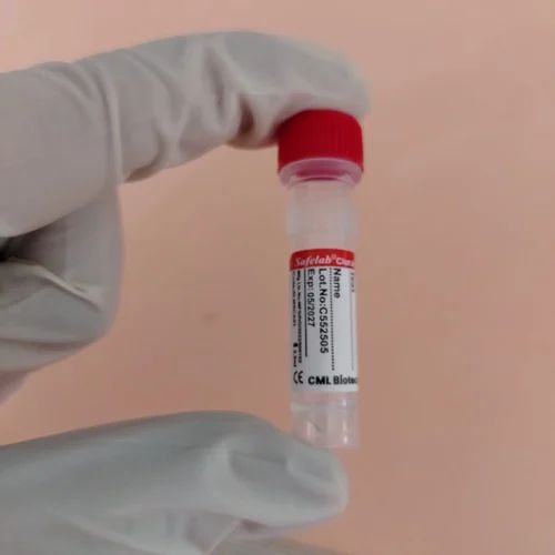 Depends On Type Blood collection micro tubes with screw cap (non vacuum), For Laboratory, 0.5 ml