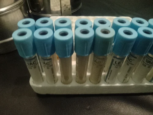Sodium Citrate Non Voccume