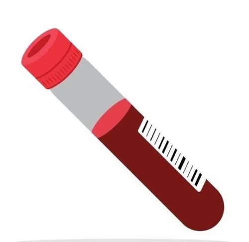 Vacuum Blood Collection Tube