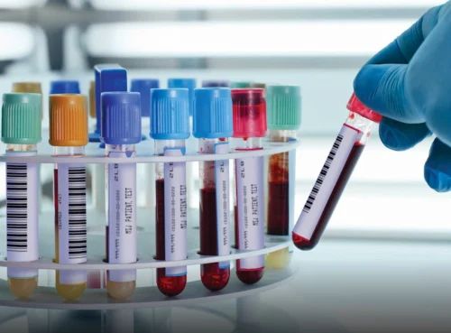 Plastic Blood COLLECTION TUBE, Size: 10 ml