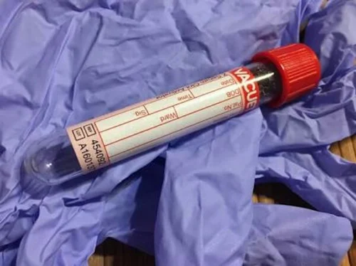 Blood Test Vacuum