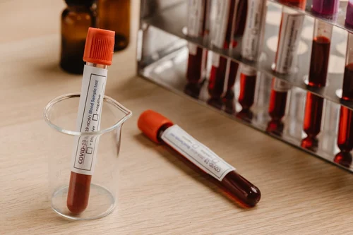 Plastic Vacuum Blood Collection Tube