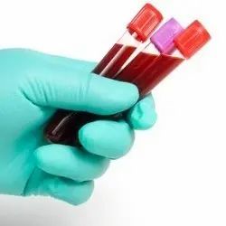 Blood Collection Tube