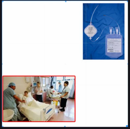 Gen World Medical Devices Filter for Hospital