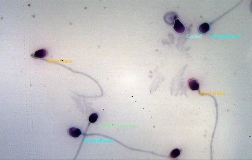 Prime Sperm Semen Analysis Instrument