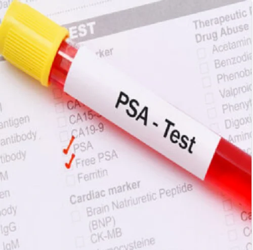 Prostate Specific Antigen pSA (Free)