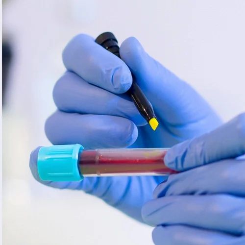 Rapitest Hcv Kit