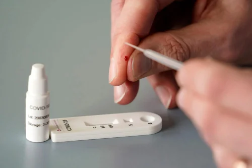 Serology Test Kit, 10 Tests