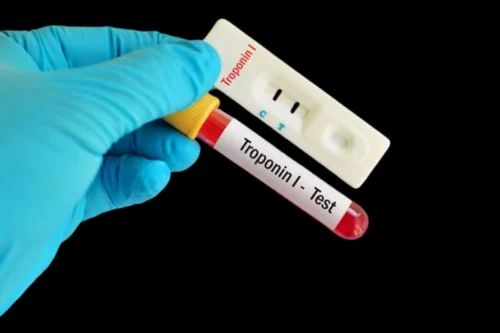 Troponin I - WB, 1 Test