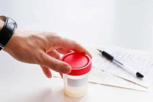 Semen Analysis