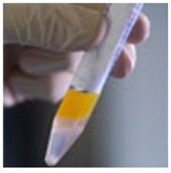 Detailed Semen Analysis