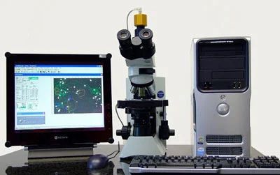 Computer Assisted Semen Analysis (CASA)