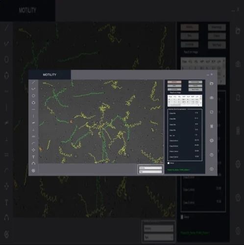 Semen Analysis - CASA Model: SpermPro, For Windows